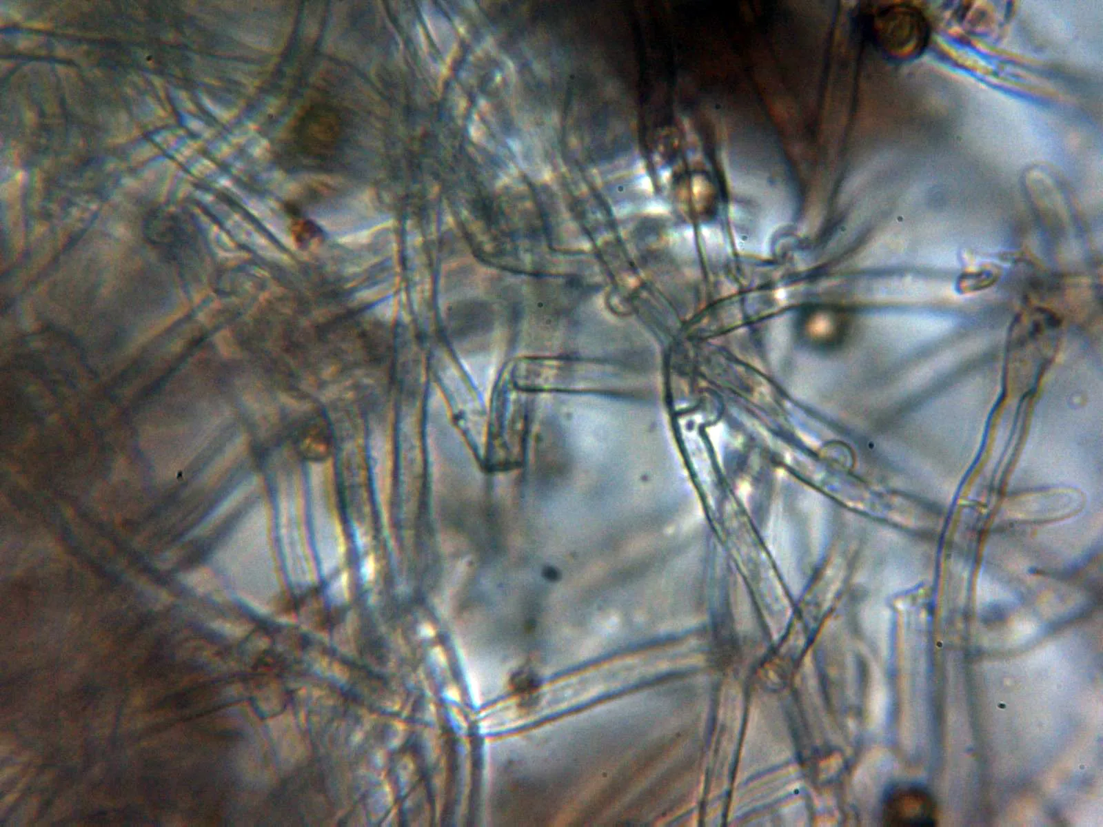 Microscopía de Lycoperdon molle - 10 - Capafina debajo peridio 1